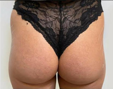 Antes da harmonização