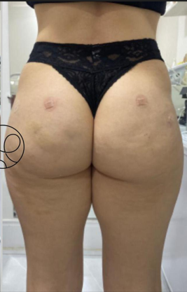 Depois da harmonização